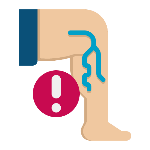 Ultrasound Bilateral Doppler Veins